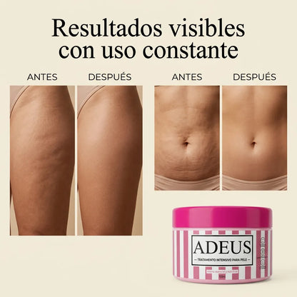 CREMA ADEUS / Control de celulites y estrias.